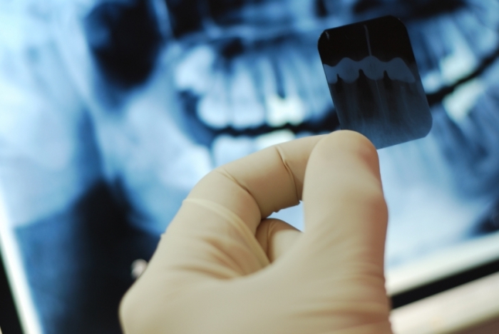 Диагностика | Клиника по зубам